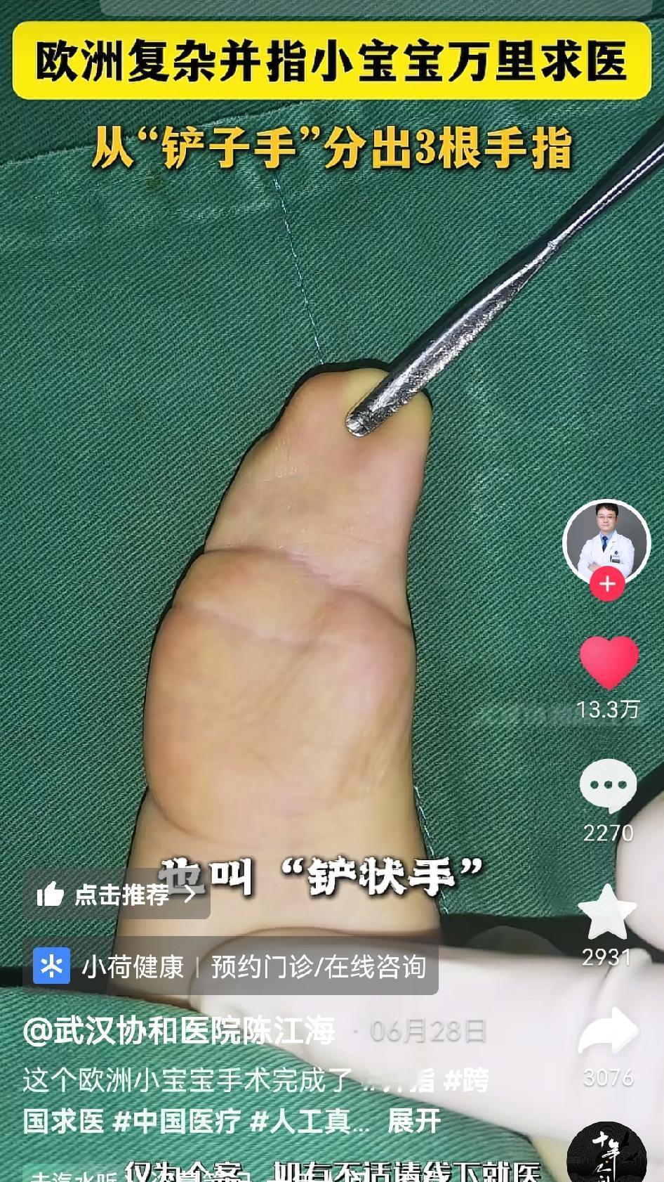 时代变了，欧洲人都开始到中国看病了！武汉协和医院陈江海医生发视频称，欧洲一个患有
