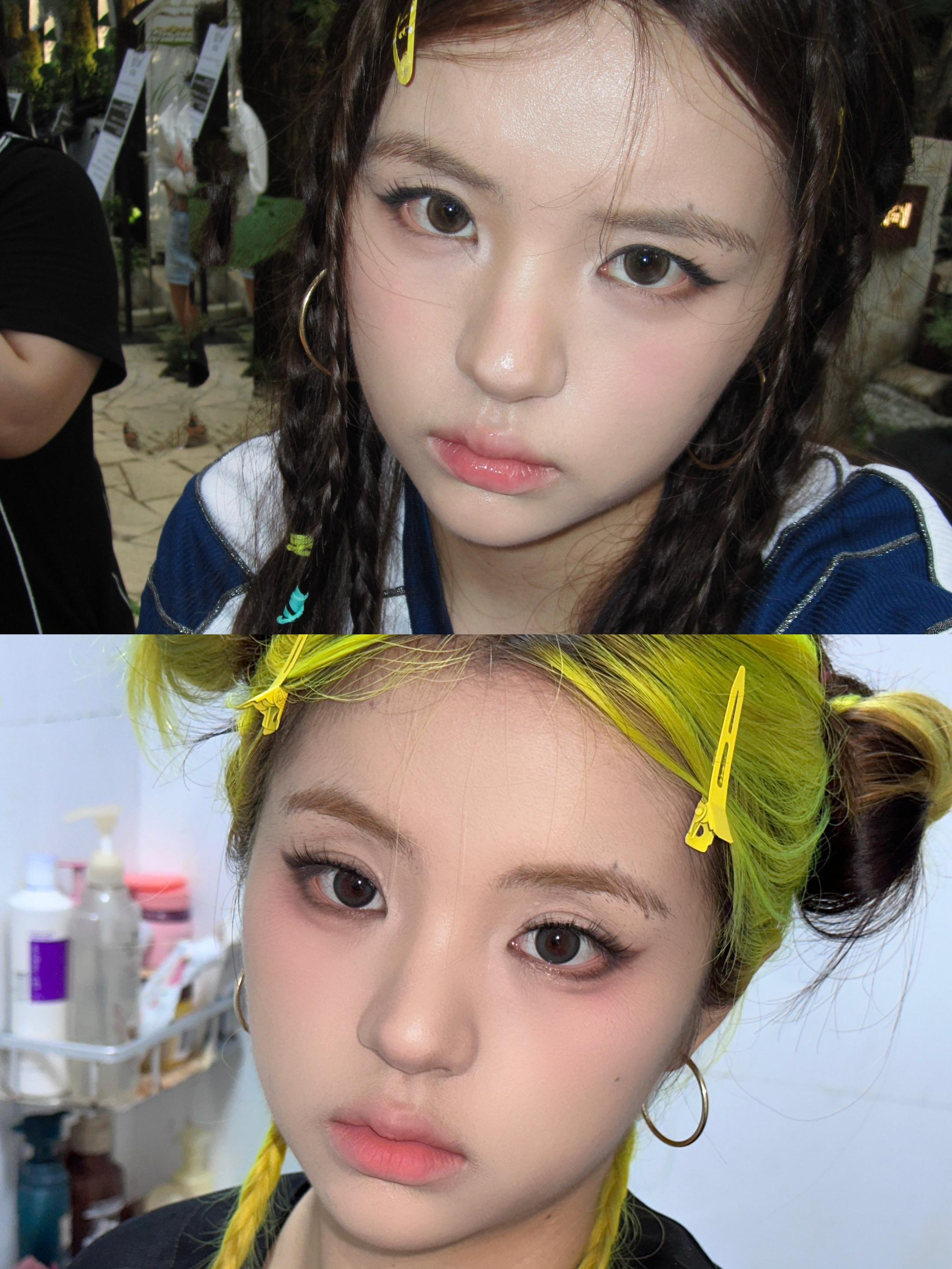 人对时间毫无还手之力。再见已是牙套脸