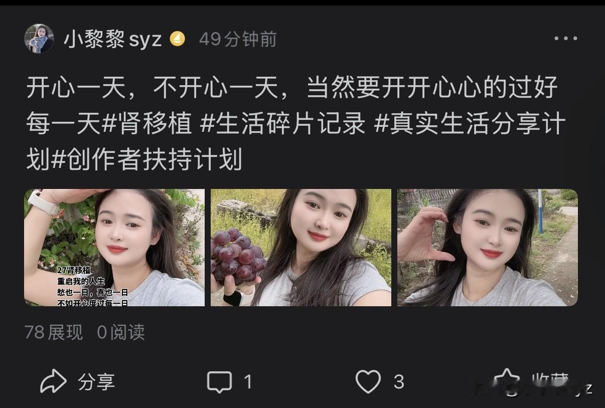 抖音它还怪好的呢！每次都把我的视频自动同步到今日头条给你们看。
自动同步这个功能