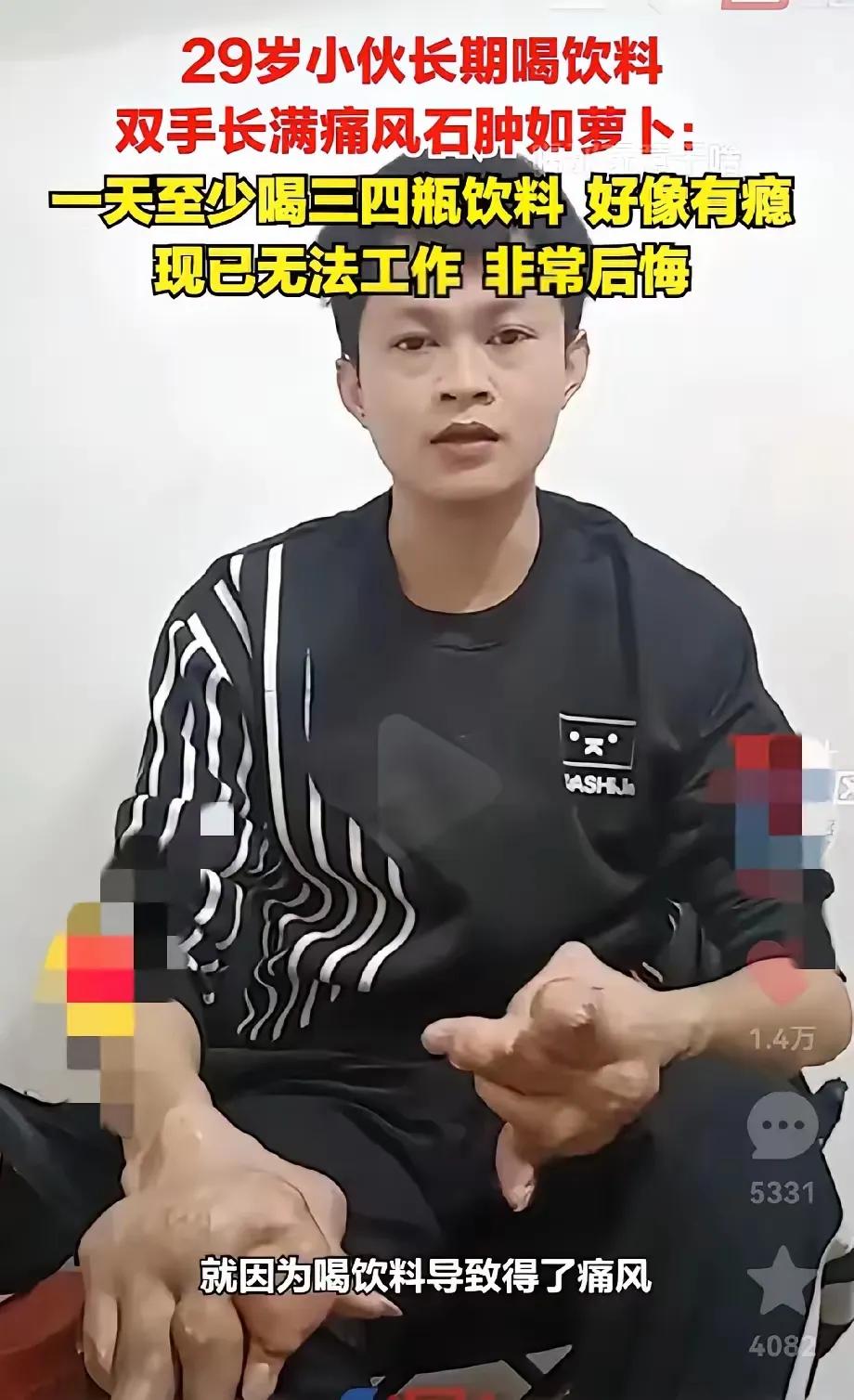 天哪，太恐怖了，所以不要经常喝饮料！！
一位29岁的男子，经常喝饮料，双手早已变