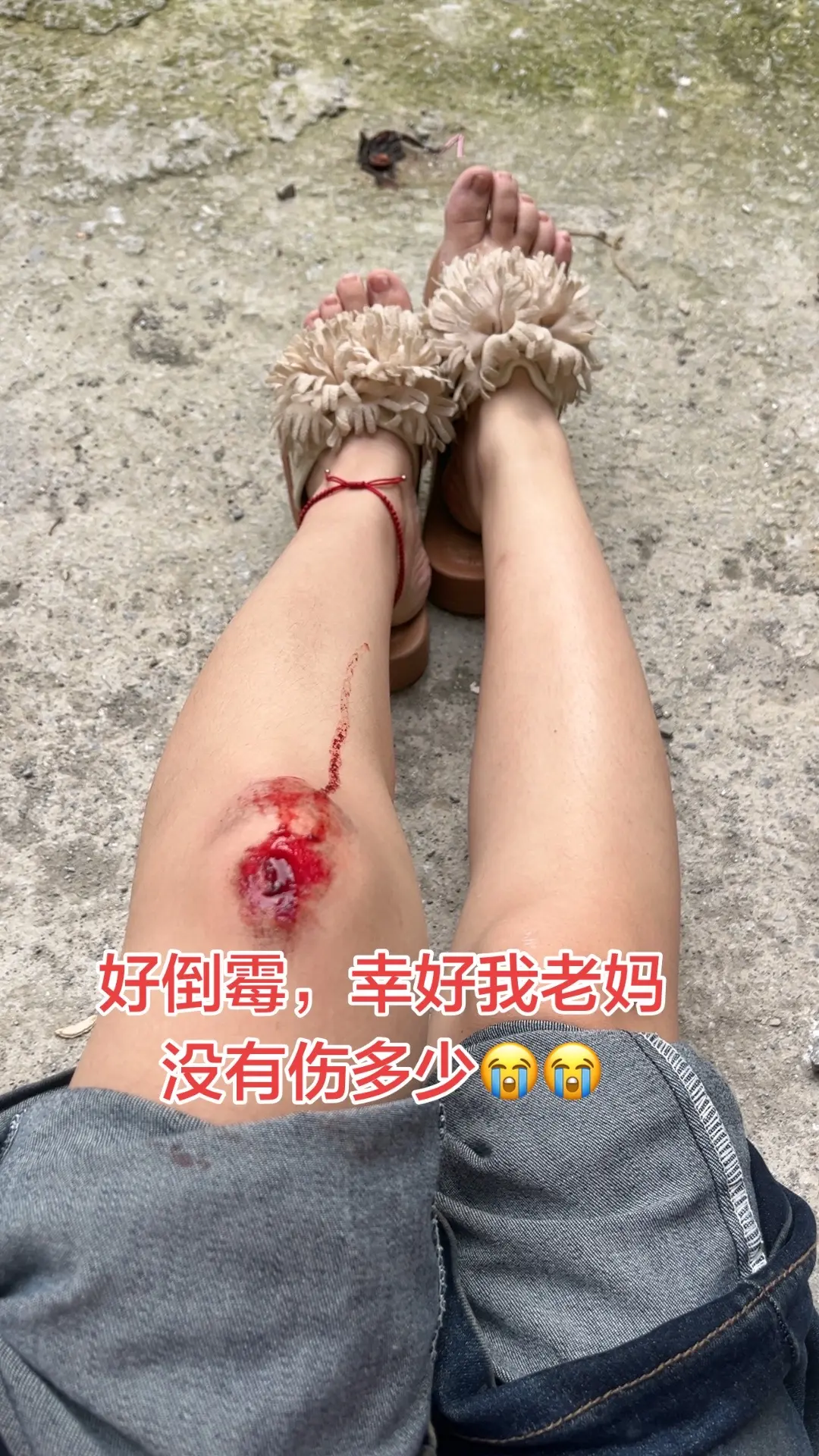 早上5:55分发生这种事，幸好老妈没伤多少😭😭