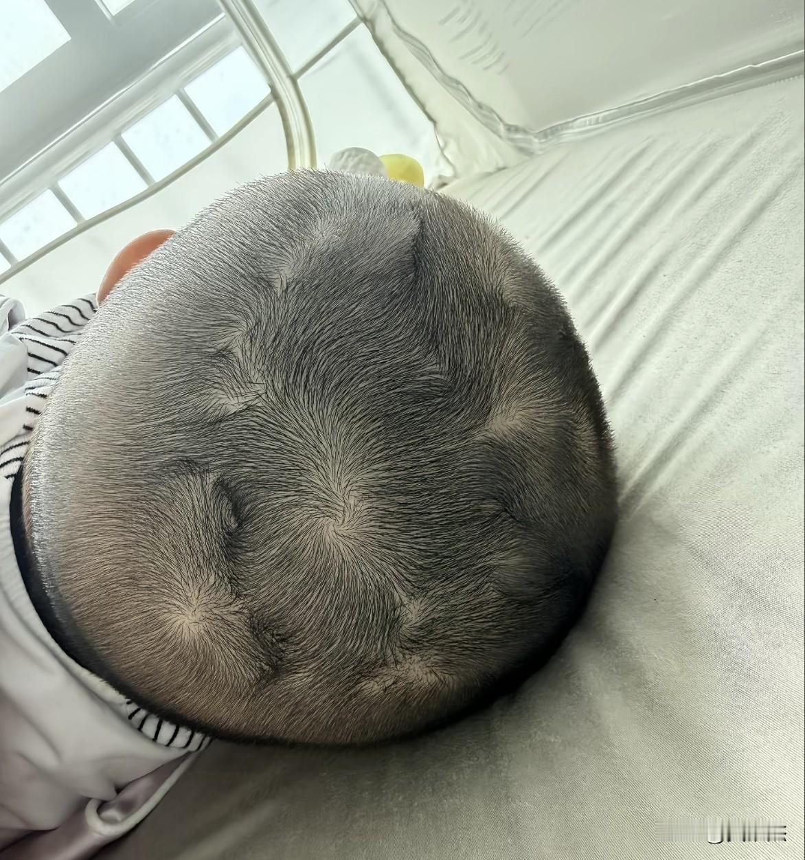 这么多头旋，你见过吗？