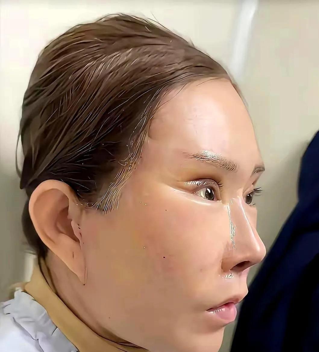 整容真的很可怕！这位美女原本颜值惊艳动人，可她自己却不满意，跑去整容，结果反倒不