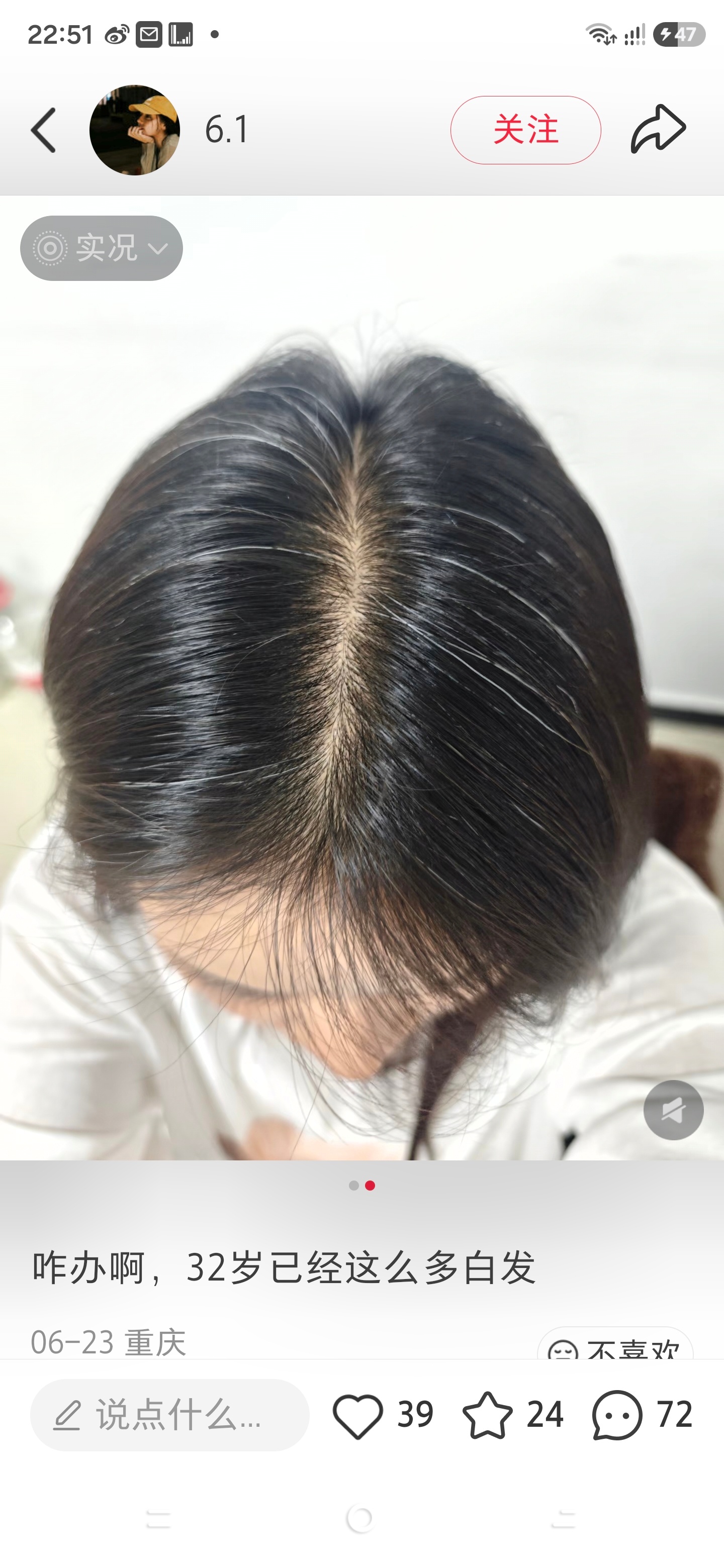 这图里不是我，我刚刚从网上看到的，我感觉我的头发就跟这个差不多，真的有很多白头发