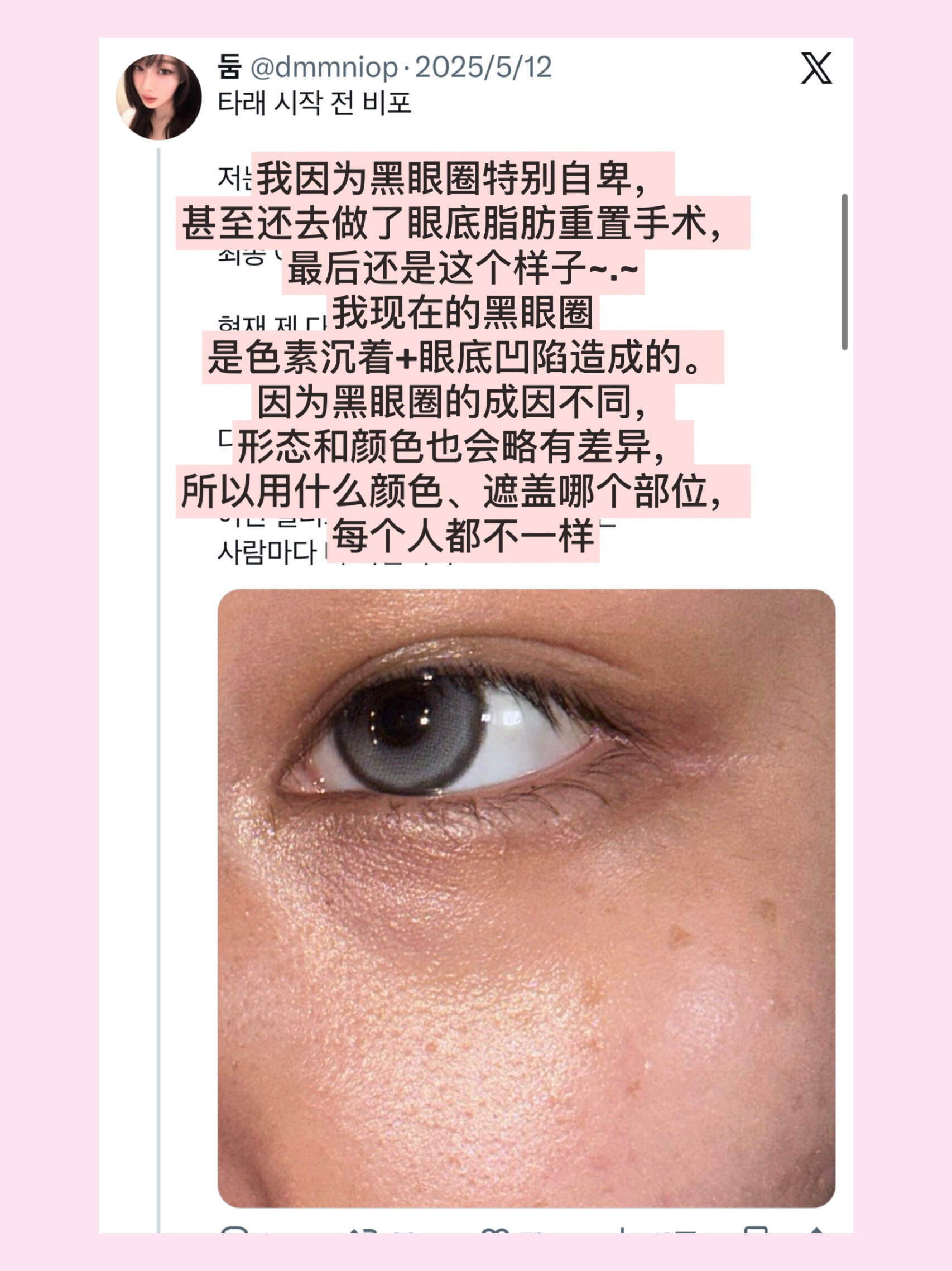 韩女神级遮重度黑眼圈教程夏一秒上妆