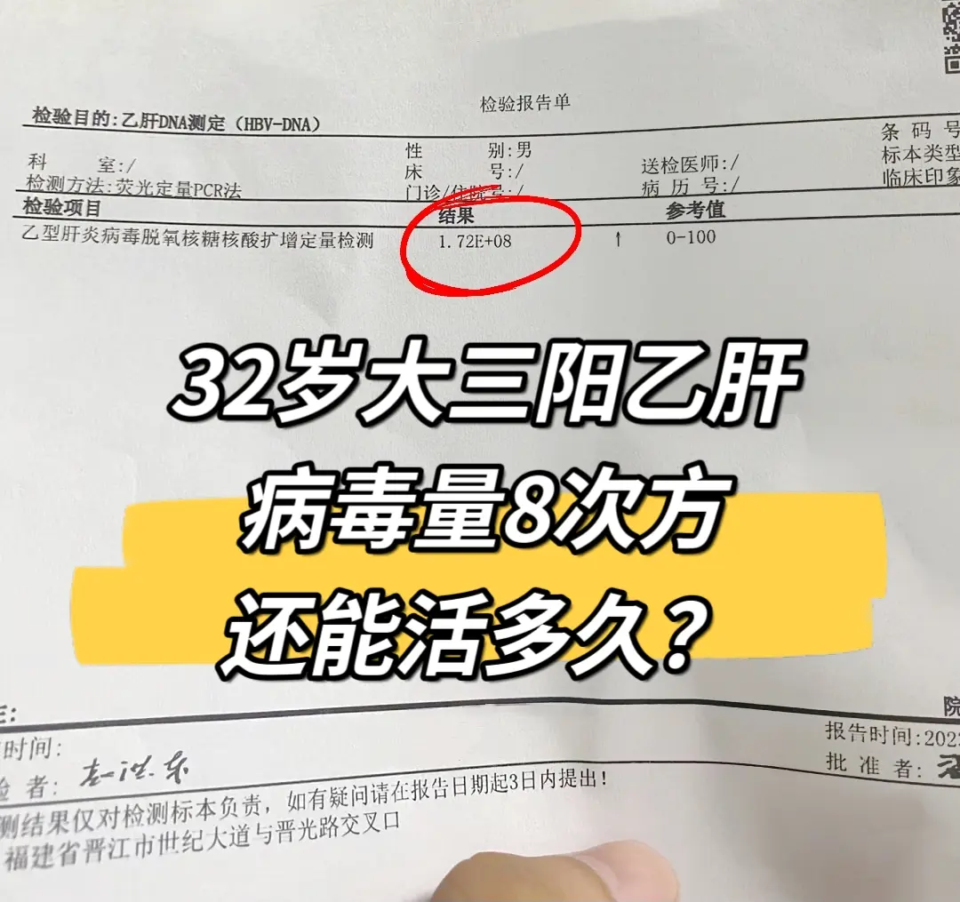 32岁大三阳乙肝病毒量8次方！我一个菏泽的老病号病号，当时大三阳，病毒...