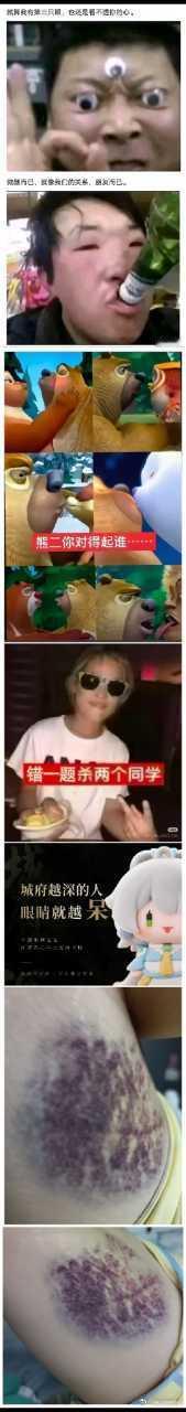 投稿，大腿被上下床的楼梯卡了一下 ​​​