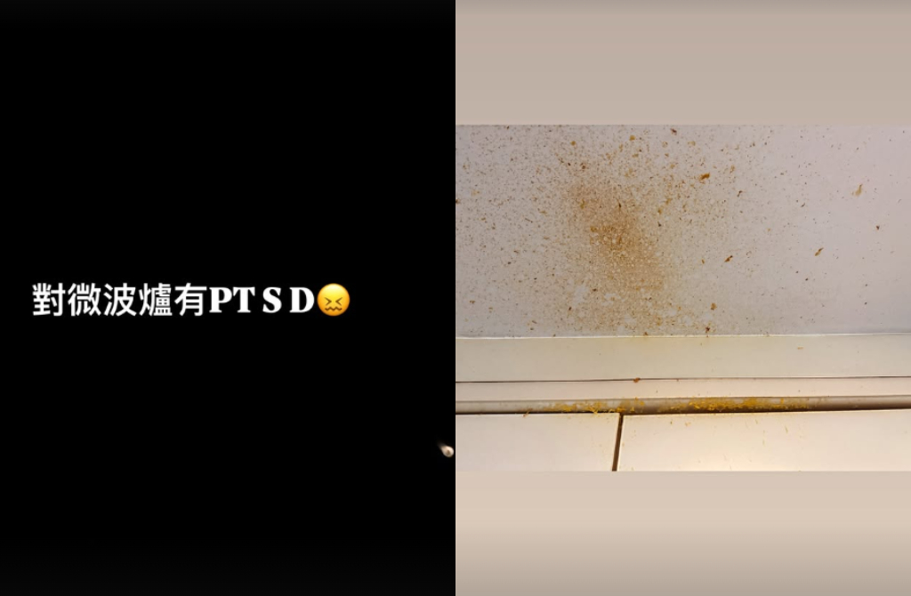 女演员微波炉煮蛋被炸伤眼睛 千万不要用微波炉煮鸡蛋啊！！！ ​​​
