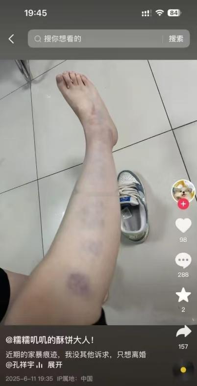 孔祥宇回应家暴 孔祥宇老婆发文说孔祥宇家暴，并发出证据。证明。随后孔祥宇回应有理