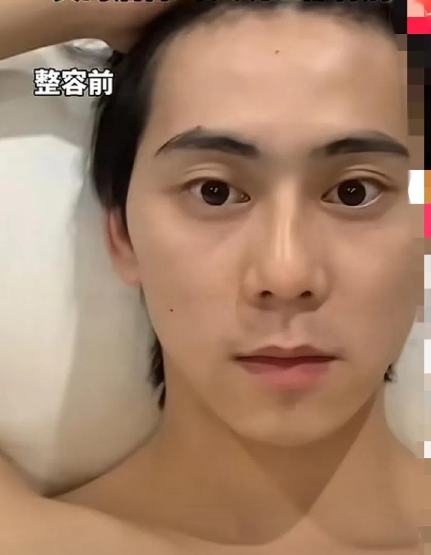 这位兄弟是有多想不开去整容，多帅算帅啊，弄的自己不都不成人形了……