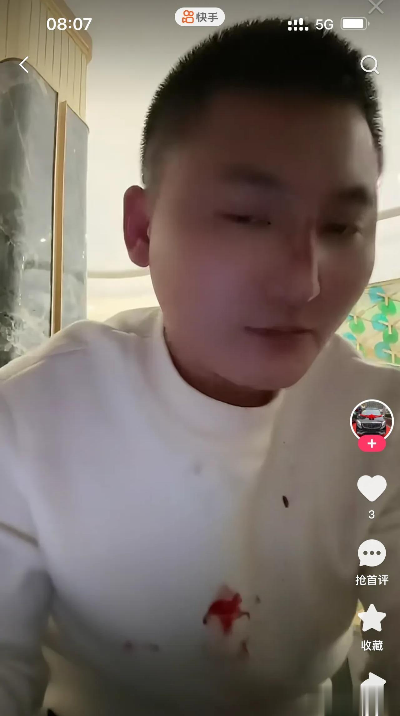 铁岭小辉ktv被打，鼻梁塌了浑身是血，破防喊话以后在长春有我没你。

铁岭小辉又