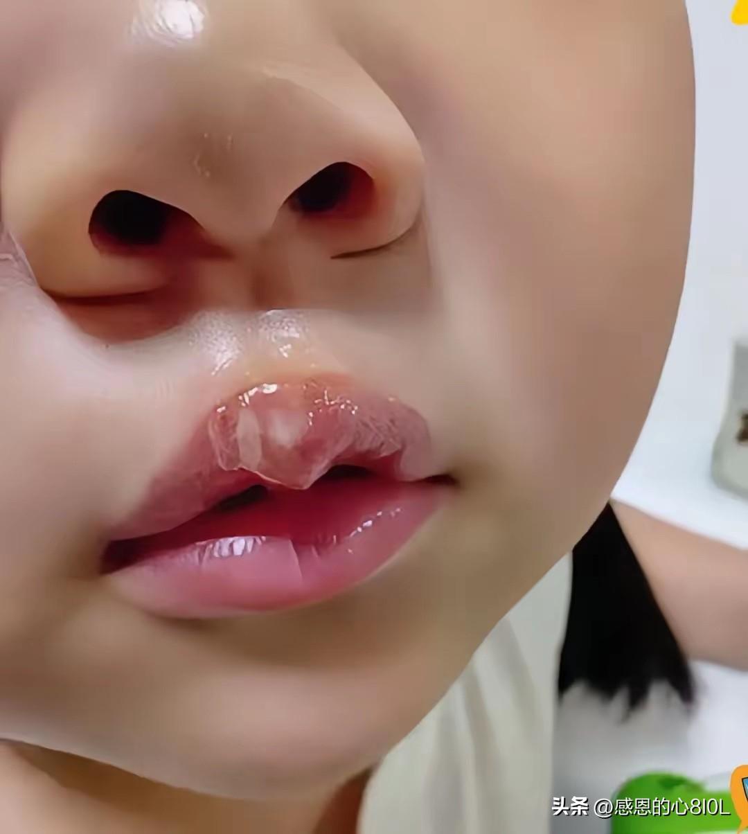 祖国的花朵，怎么能容忍这样摧残。
刚才刷手机，看到了，有一家幼儿园，两名幼师用热