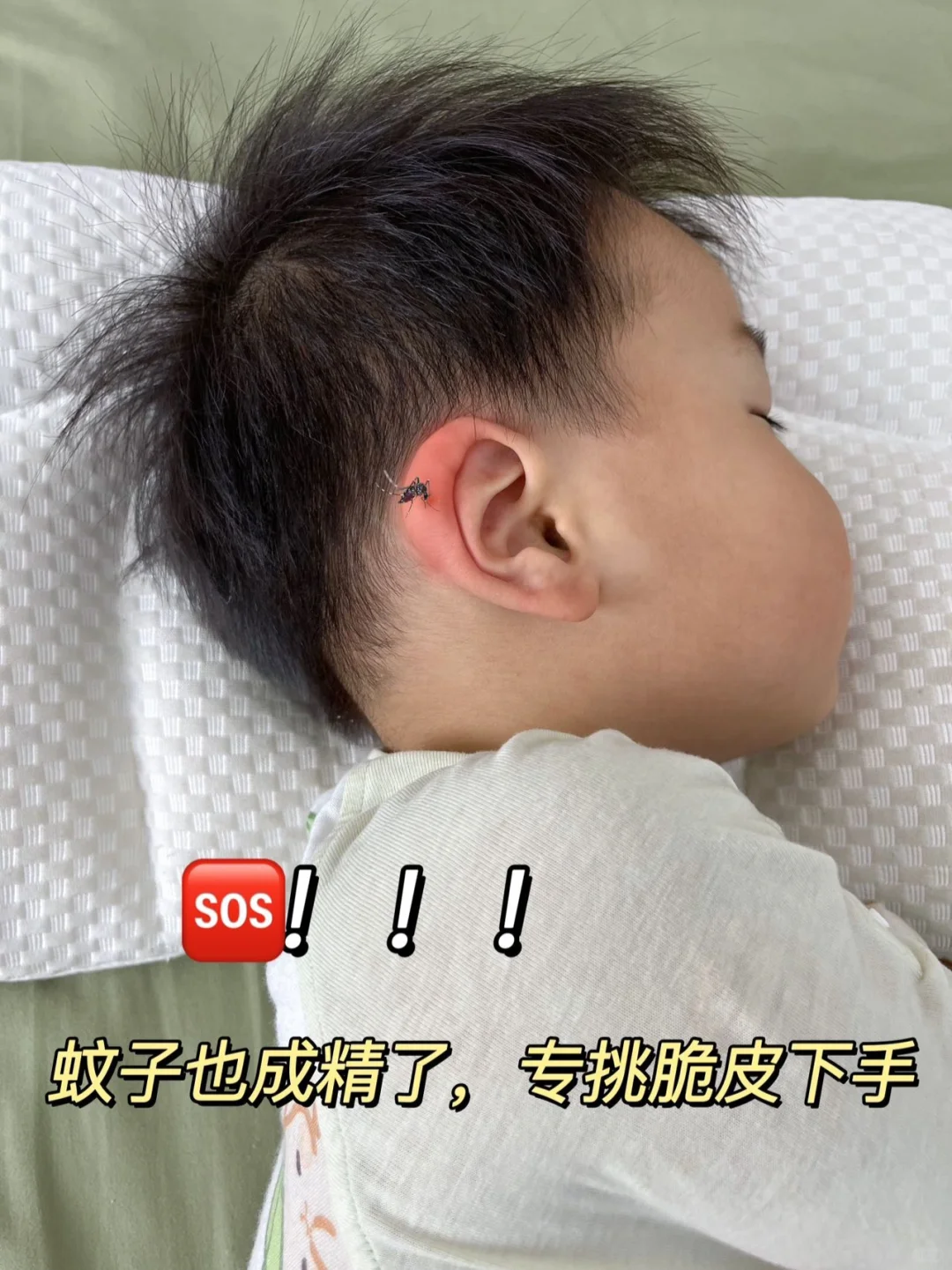 没被蚊子咬肿耳朵的幼年是不完整的....