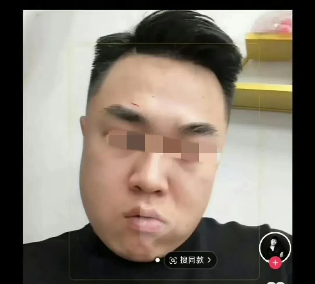 这男的一看就一脸凶相
有多大仇恨呢？
对一个15岁的女孩大打出手？怎么面对自己孩