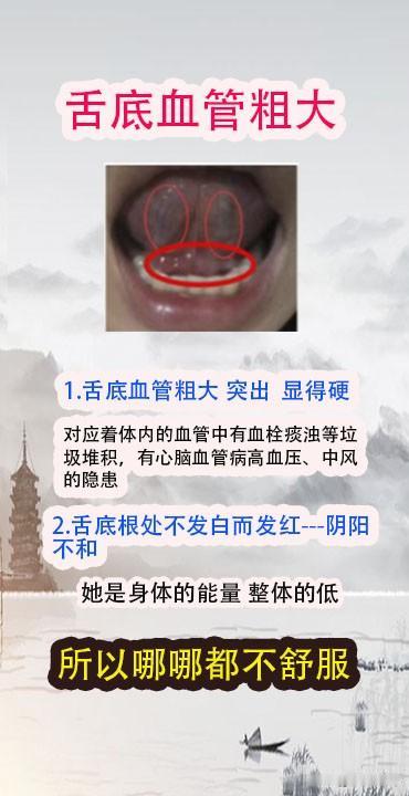 实用的舌诊案例分析#中医养生#
