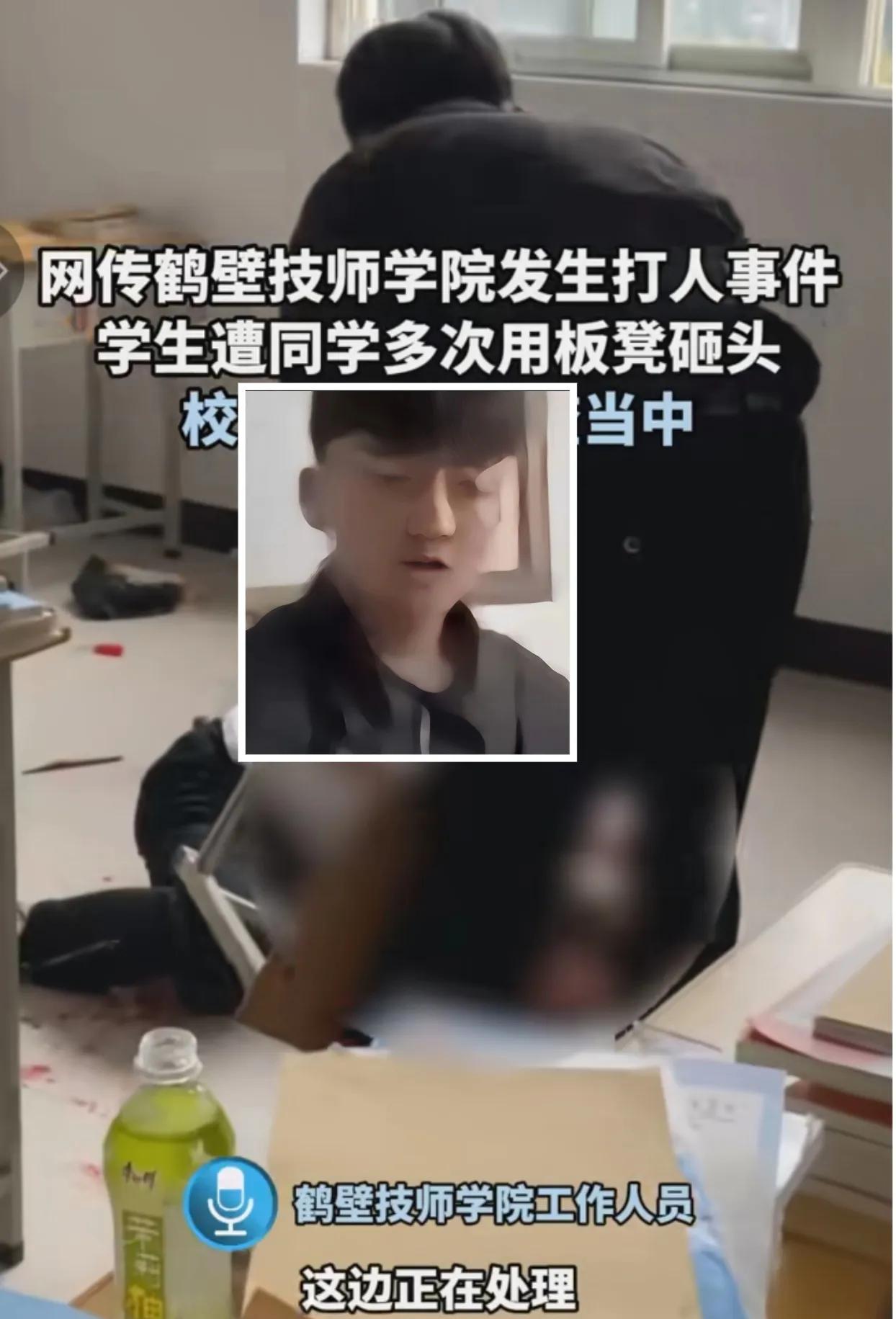 谁知道鹤壁技师学院，被板凳暴打头的男生，到底伤情怎么样了？看着太危险，太让人心痛