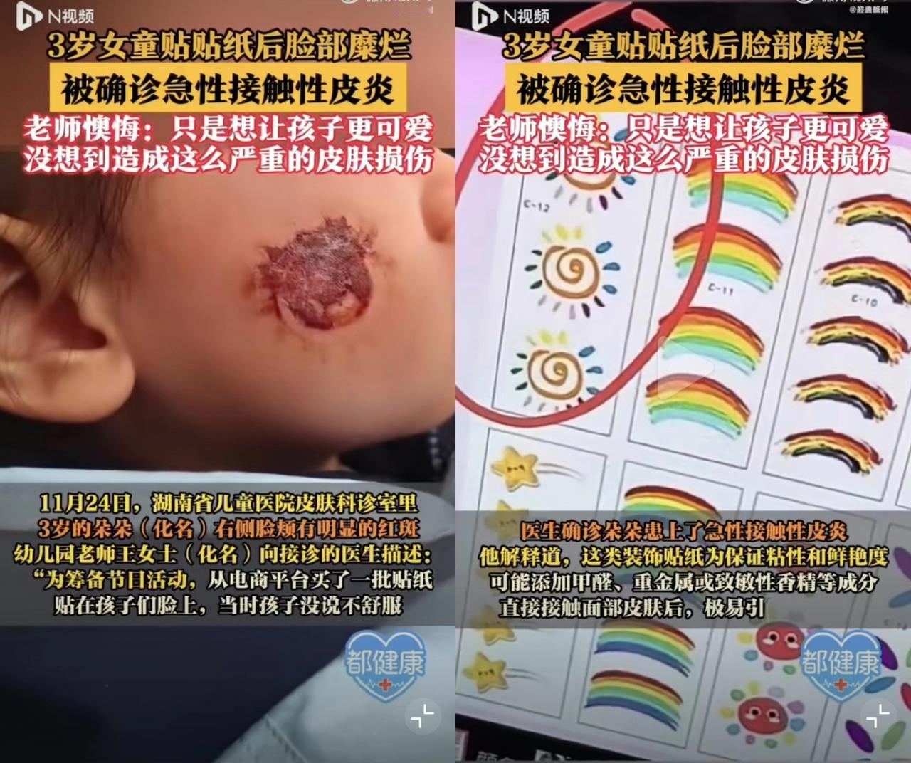 看到这一幕，

所有的宝妈都破防了！

长沙3岁女童朵朵因为幼儿园搞活动，脸上贴