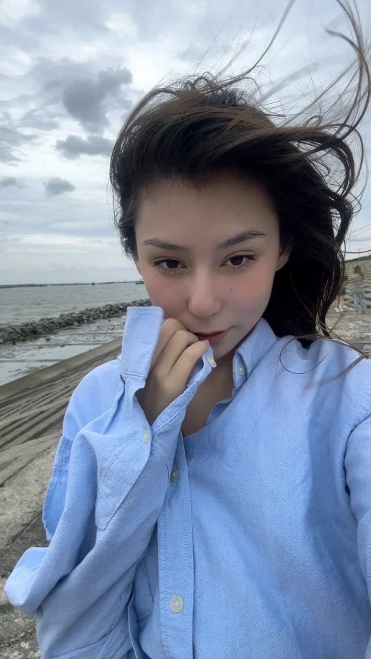 杭州玻尿酸改善眼窝凹陷，怎么试试~