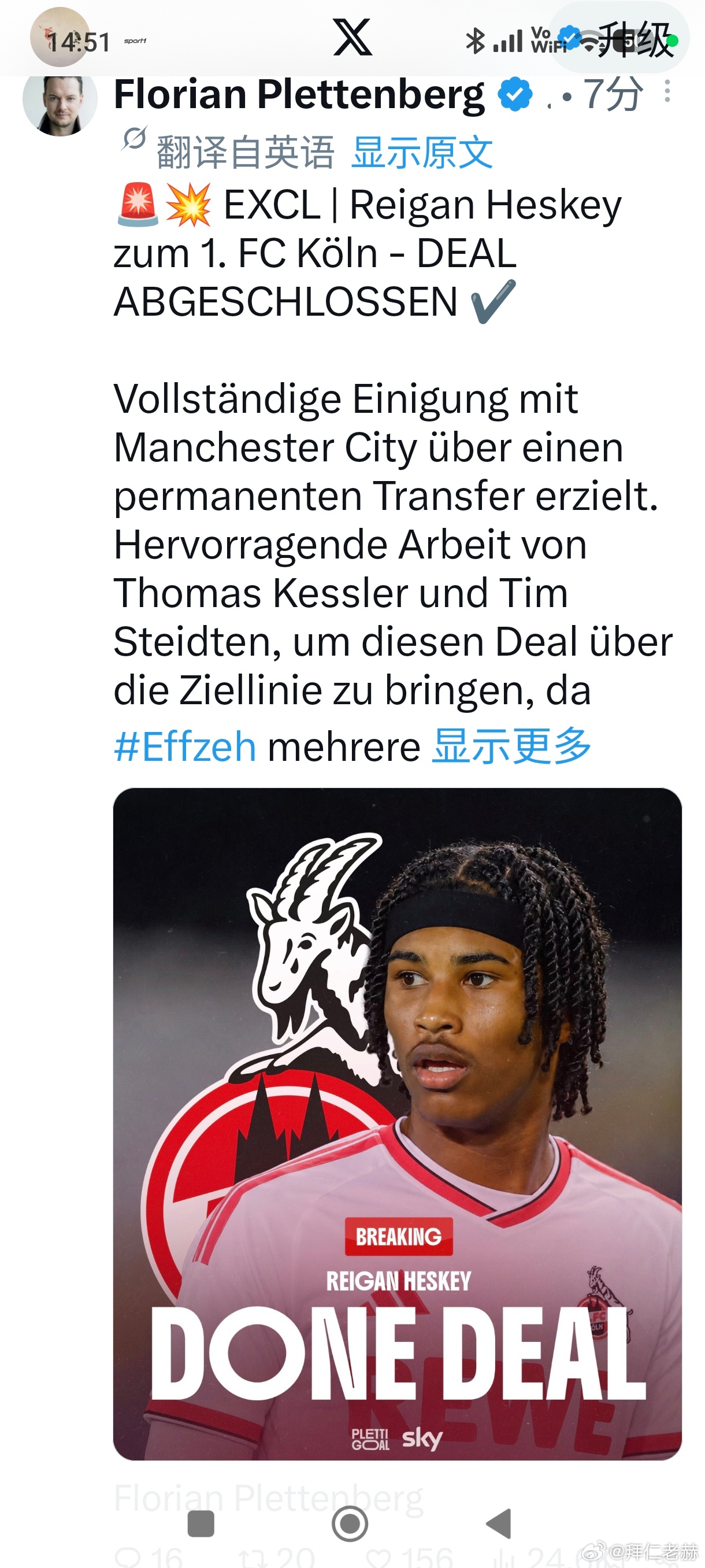 这真的不是个拜仁的球员？年纪大了，眼花！拜仁拜仁