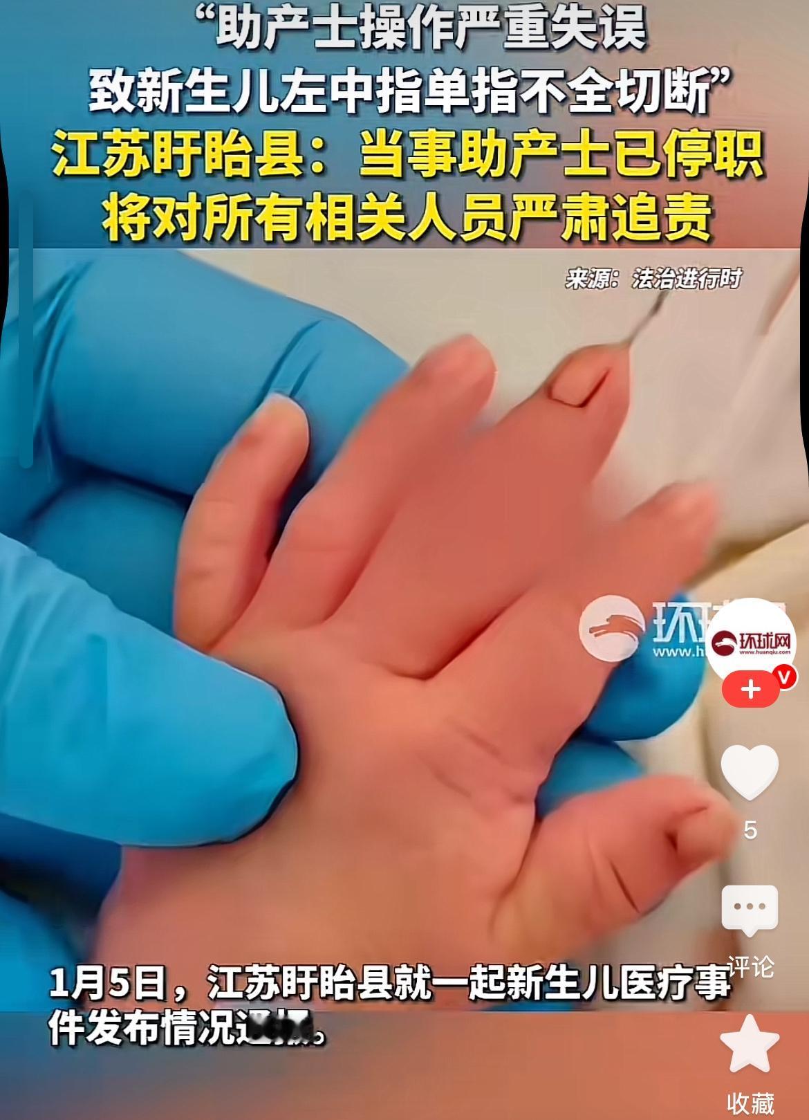 当了妈妈之后最看不得这个，
刚出生的婴儿骨头都还特别的嫩，
就这样被硬生生的剪断