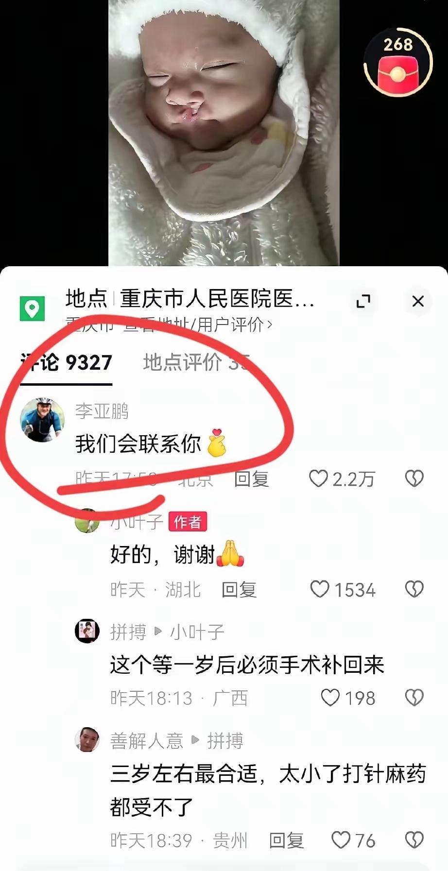 李亚鹏好仗义好有爱[赞][赞][赞]。李亚鹏也像我们一样在网络冲浪，看到一个唇腭