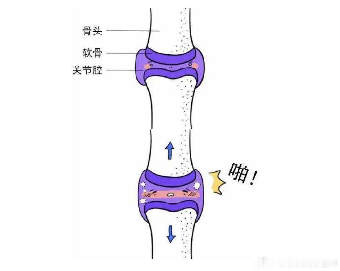 随意按摩正骨有风险  最近又看到有些朋友在问，我哪里哪里不舒服，可以去正骨/按摩