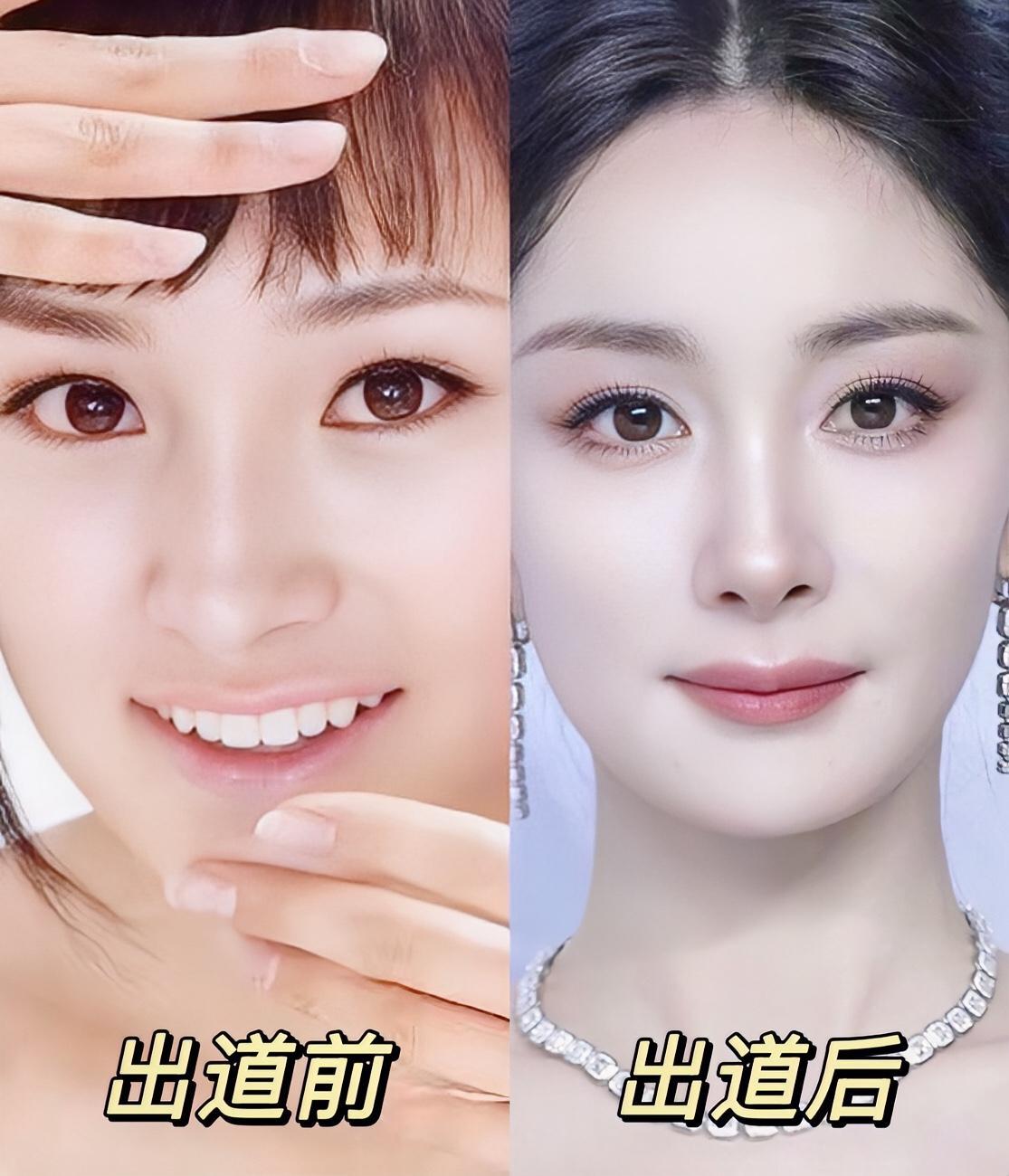 好想问在哪拔的牙能消失下颚骨，诚心问姐妹们求推荐牙医