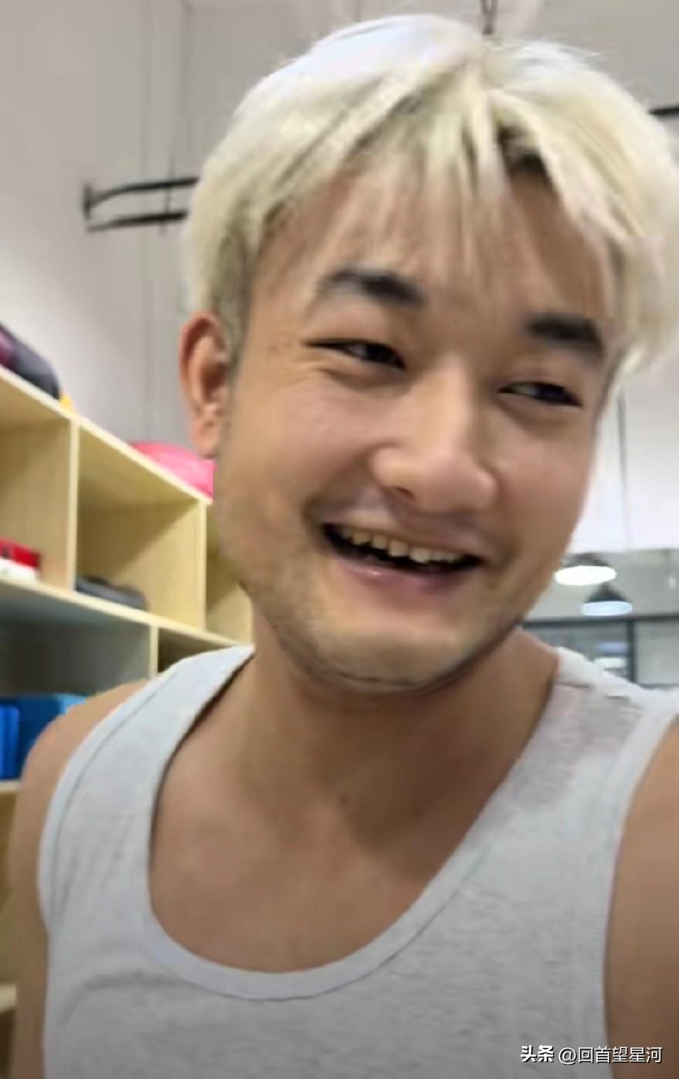 丛明晨退役后的生活过得很开心，现在正在养伤康复训练中的丛明晨染了一头黄发，脸上总