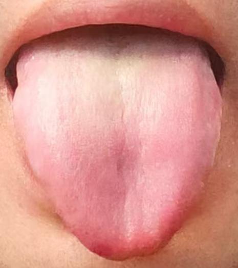 心肾同调稳固本源，温阳固本，重拾身心良好状态






有不少年轻的朋友总是在