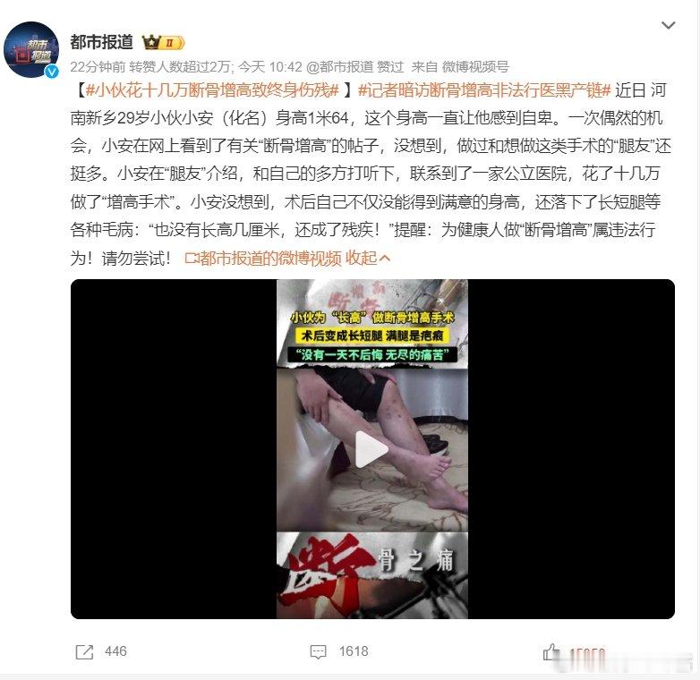 早上一个小伙子，下午一个女子花60万断骨增高落终身疾病，都是高位热搜……咋了这是