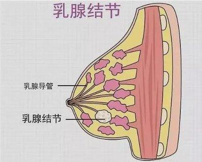 4A类结节，都要手术切除吗？医生给出专业建议
疫情过后查出结节的人确实日益增多，