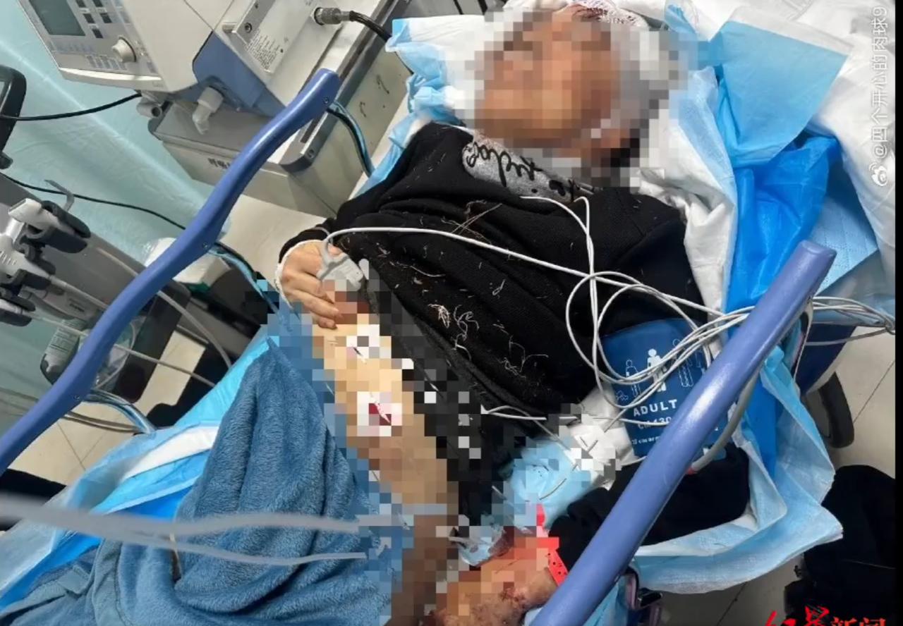 “必须严惩！”吉林长春，62岁老人在徒步时，突然被从附近院子冲出的7只大狗扑倒。