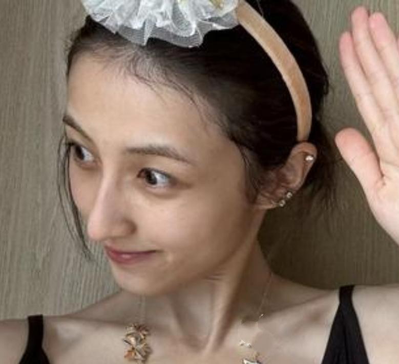 张子枫在25岁生日（8月27日）时晒出了一组全素颜生日照。照片中她身形暴瘦，脸颊