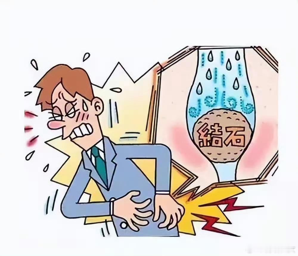 #剧烈运动跳掉肾结石能有多疼#咱就是说，医生会建议你平时多喝水，多排尿，通过这种
