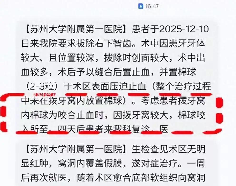 一男子在医院拔牙，剧痛七天后发现伤口内竟缝入两公分棉条，院方短信称棉条系患者自己