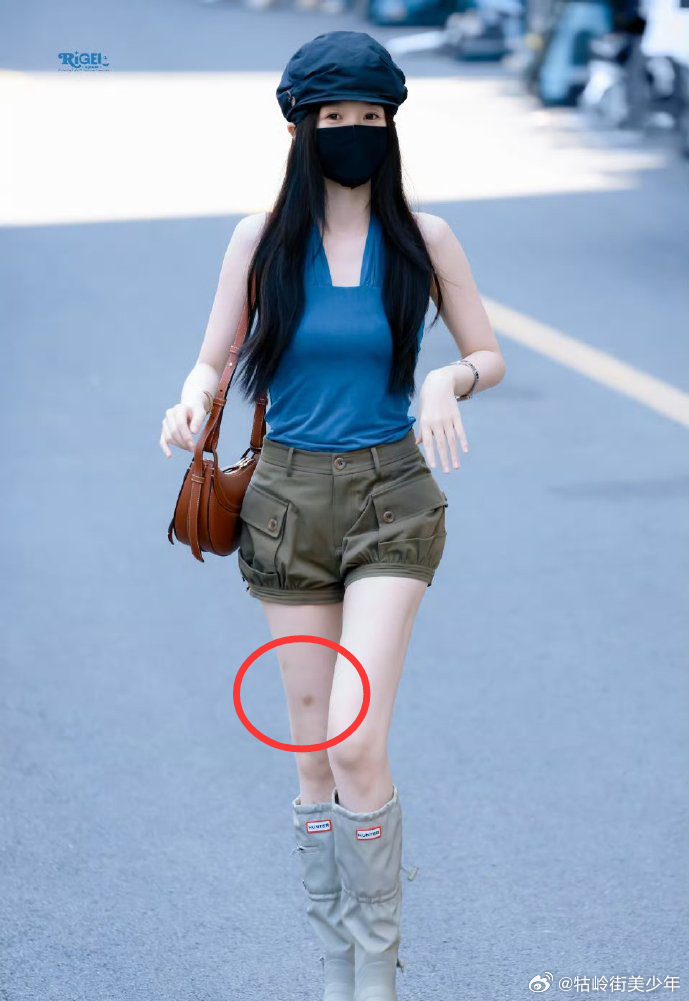 虞书欣大腿淤青，找了半天，原来在这↓ 