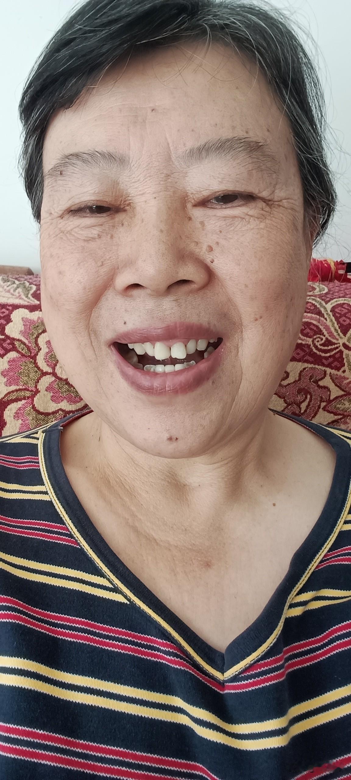 人到了老年以后，会发生好多奇怪的事情，想头发变白是自然规律，腿脚不灵也是自然规律