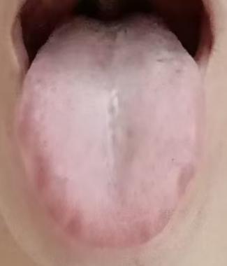 下焦气滞血瘀的典型表现与体质调理思路







前段时间有位男士咨询，日常排