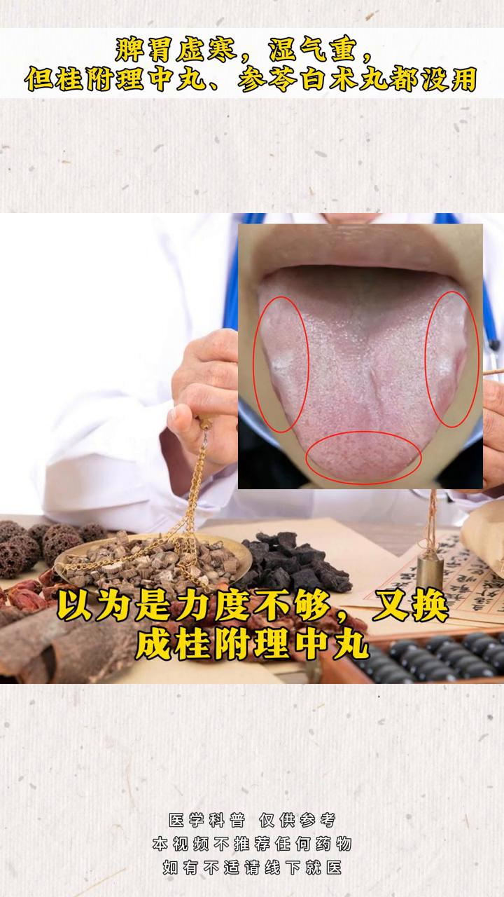 脾胃虚寒、湿气重，但桂附理中芄、参苓白术芄都没用。
主诉：怕冷，不敢吃凉的，容易