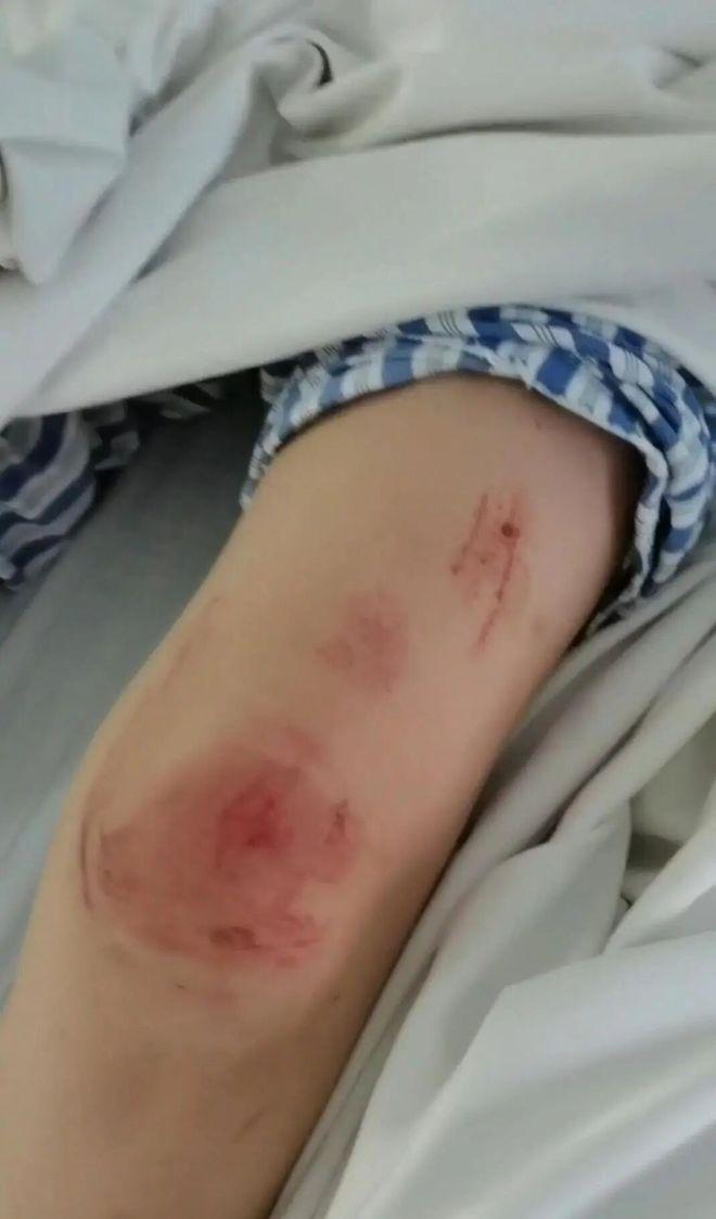 丧心病狂！女子遭丈夫殴打全身扒光，驾车逃跑致丈夫身亡，一审获刑11年！家属不肯放