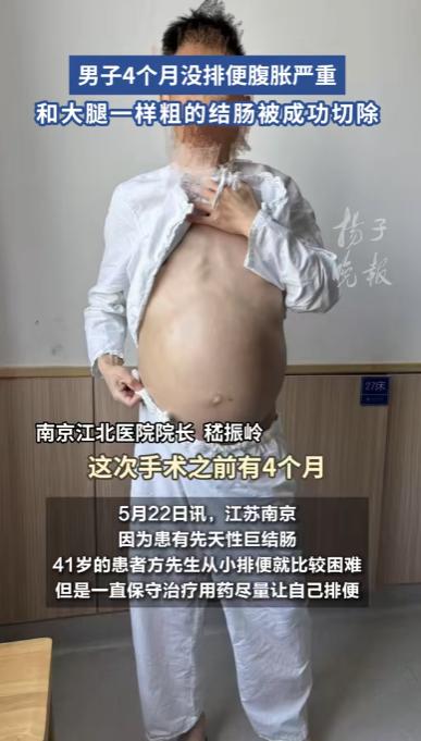 不敢相信！南京一40岁男子，4个月没有排排便，实在扛不住了才去看医生，结果，医生