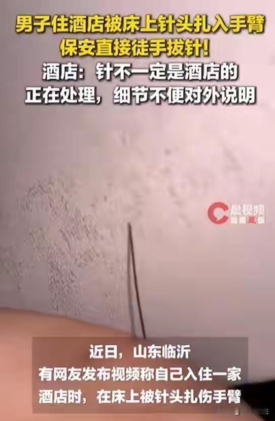 山东，一男子住进酒店，洗完澡后刚要休息，突然被一针头扎进了手臂，酒店保安赶来，徒
