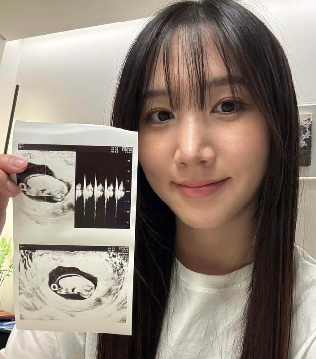 Apink前成员洪瑜暻当妈Apink前成员洪瑜暻宣布怀孕  Apink前成员洪瑜