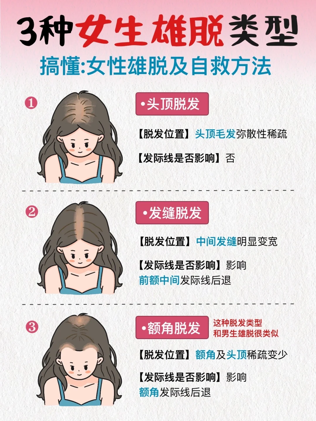 女生雄脱真相！可别再乱抗雄了
