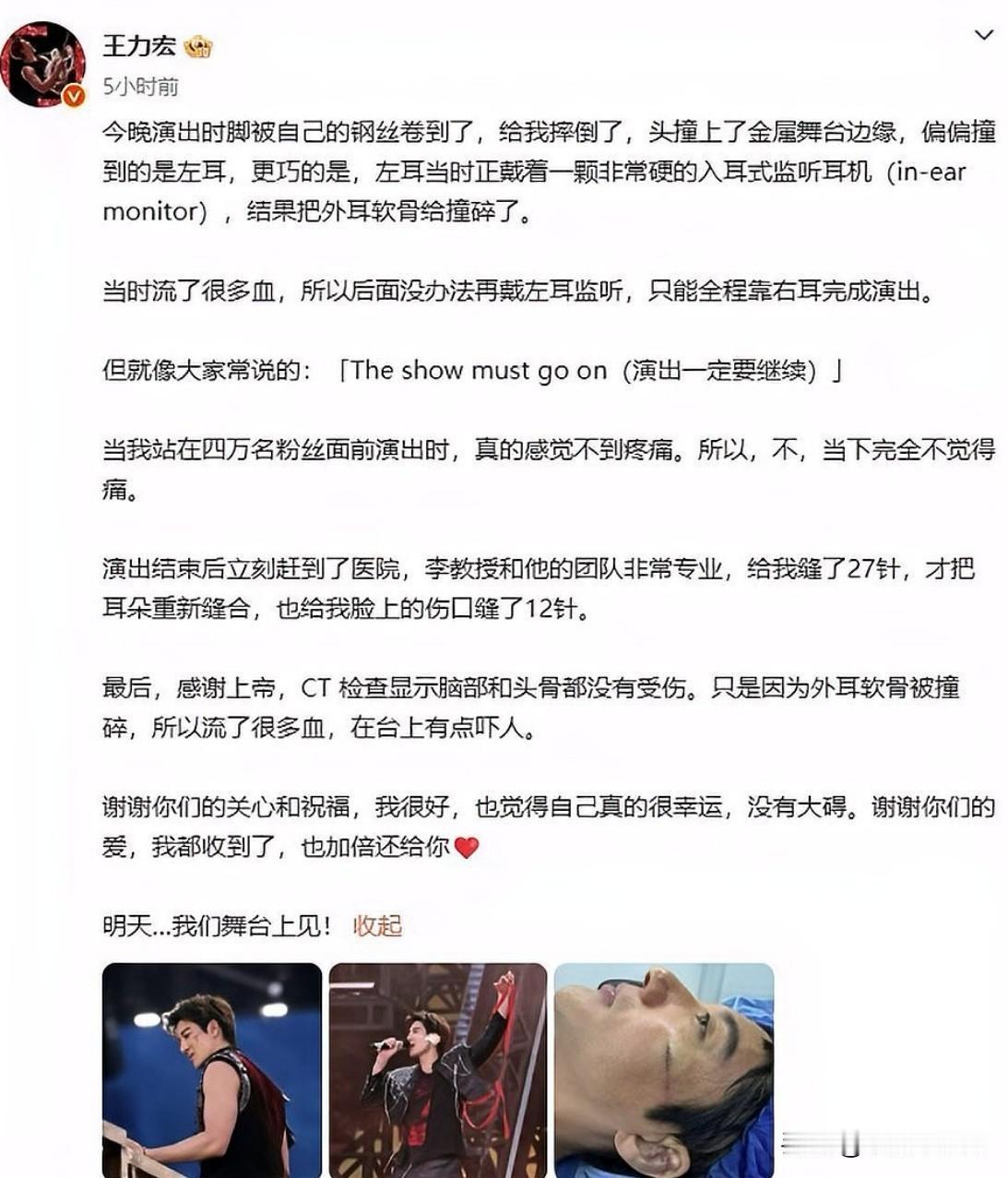 舞台上意外摔倒，王力宏带伤唱完全场，耳朵缝27针、脸缝12针的伤势背后，舞台安全