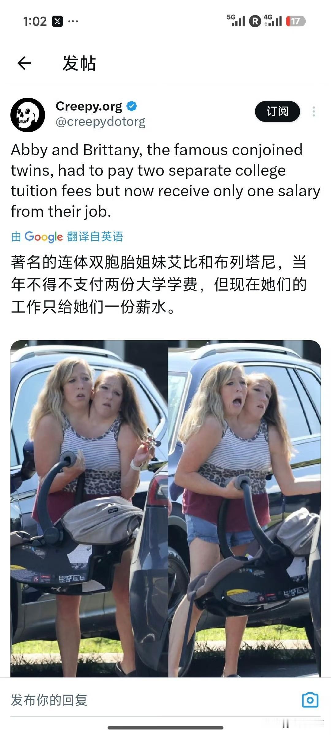 当年连体双胞胎姐妹上大学，交两份学费，现在打工却只能领一份工资，网友建议，用脚再