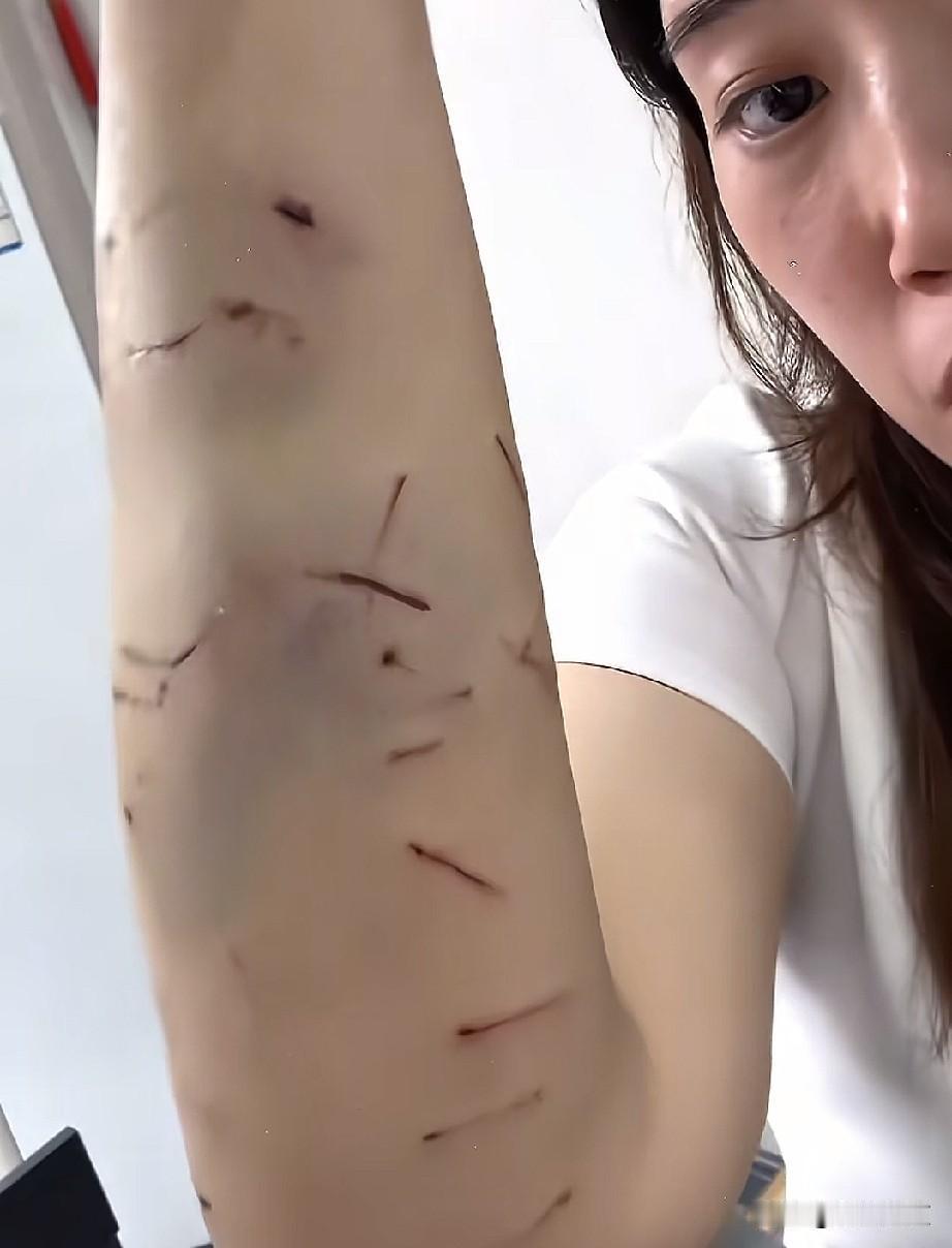 碰到这样的猫怎么办？女主人怕夏天热在给他剃毛的时候，对女主人疯狂攻击，这身上被抓
