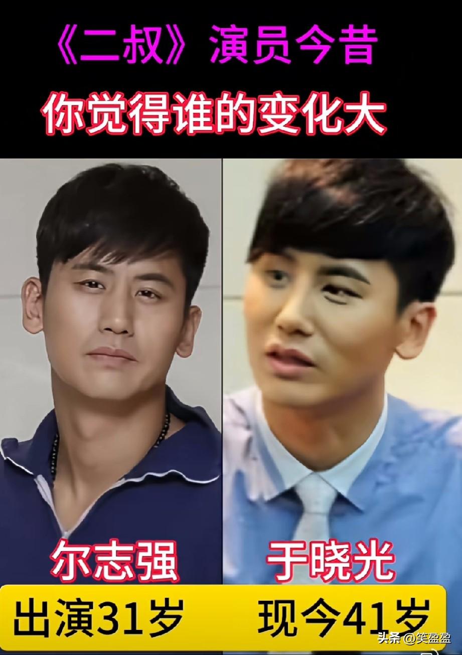 《二叔》演员今昔对比
你觉得谁的变化大？