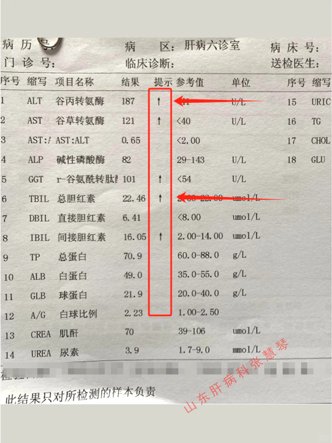 肝功能报告单上，留意这2项指标不要升高