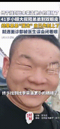 近日河南一个41岁大叔本来是陪着弟弟去割双眼皮，想着让弟弟颜值提一提，结果到了地